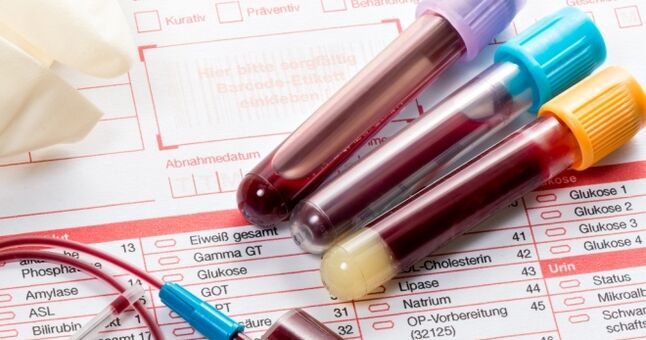 การตรวจเลือดสำหรับฮิวแมนแพพพิลโลมาไวรัส