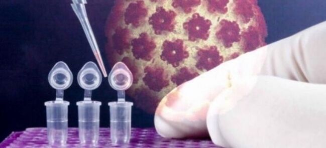 การวินิจฉัย HPV โดยใช้การทดสอบ digene